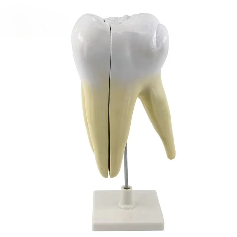 Human molar anatomy model Kindergarten dentals teaching aids 6 times large tooth anatomy model