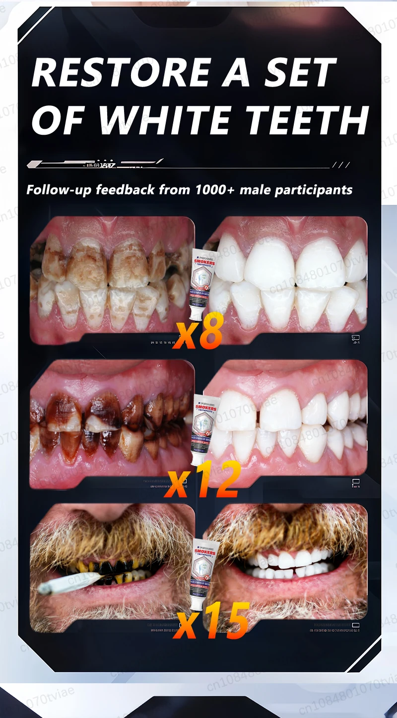 POZOAMIS 30% Hydroxyapatite Toothpaste, For Home Use, Deeply Cleans And Whitens Teeth, Freshens Breath, Protects Gum Health, And Removes Plaque And Tartar.