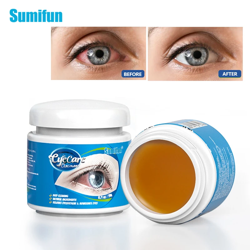 Sumifun Herbal Eye Cream Improve Eyesight Myopia Relieve Eye Fatigue Dryness Ointment Remove Red Blood Streaks Medical Plaster