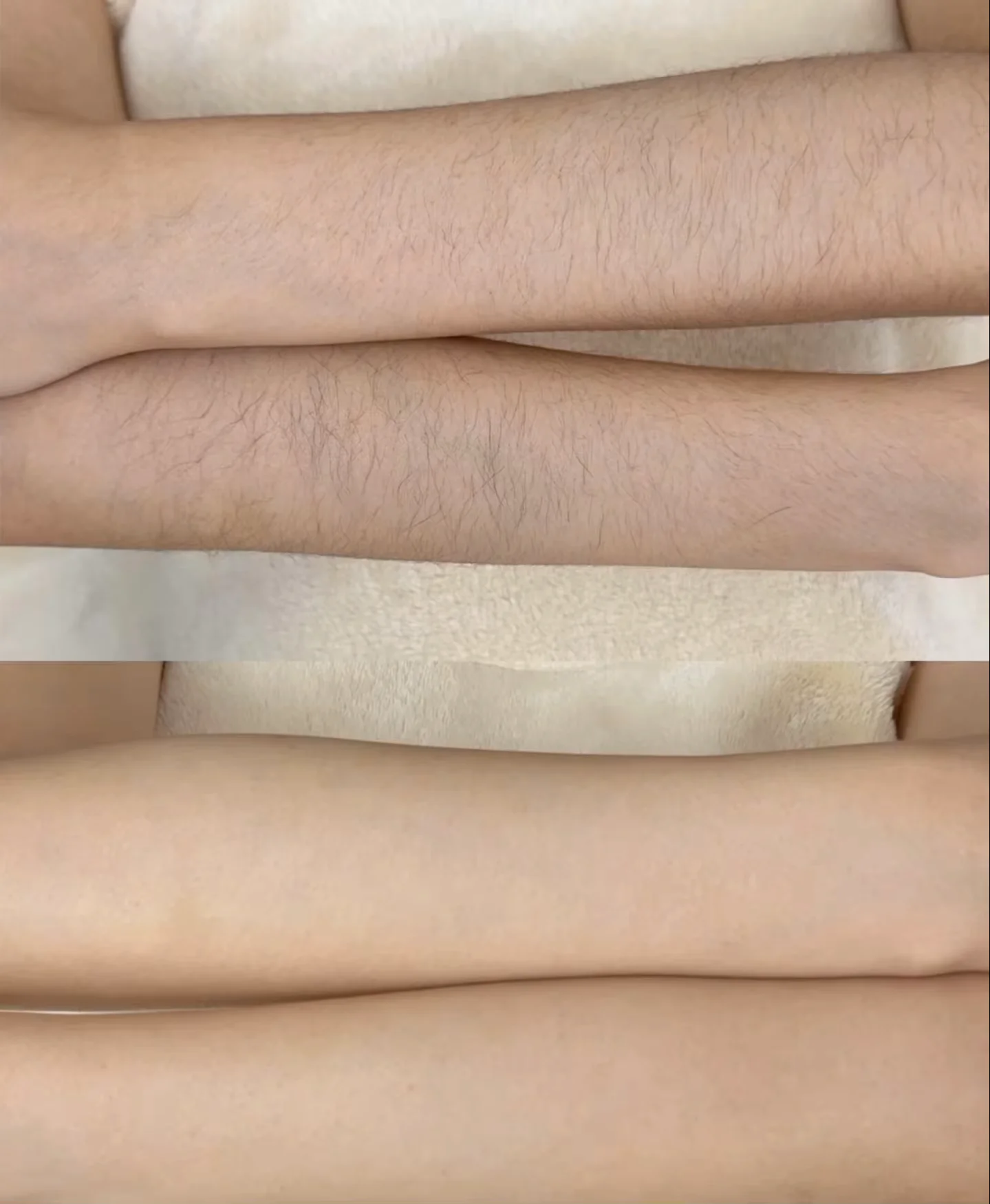 

Новейший портативный безболезненный лазерный аппарат 2-в-1 для удаления волос и пикосекундный лазер 2026 года, 4000 Вт, подходит для всех типов кожи, профессиональный диодный лазер