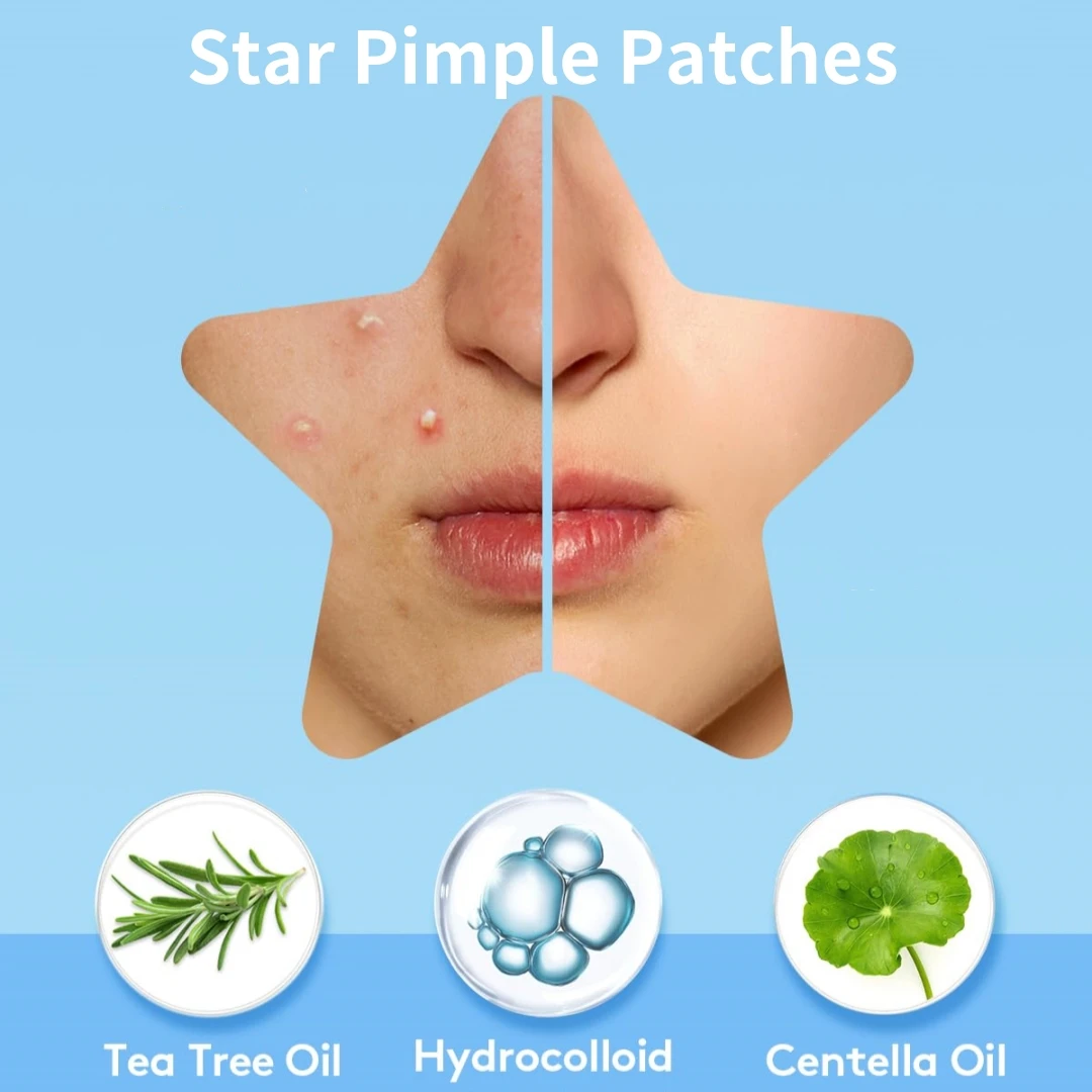 51개입 하이드로콜로이드 여드름 패치—항균, 흡수성 흉터 치료 패치, 특히 여드름 치료용으로 설계되었습니다.