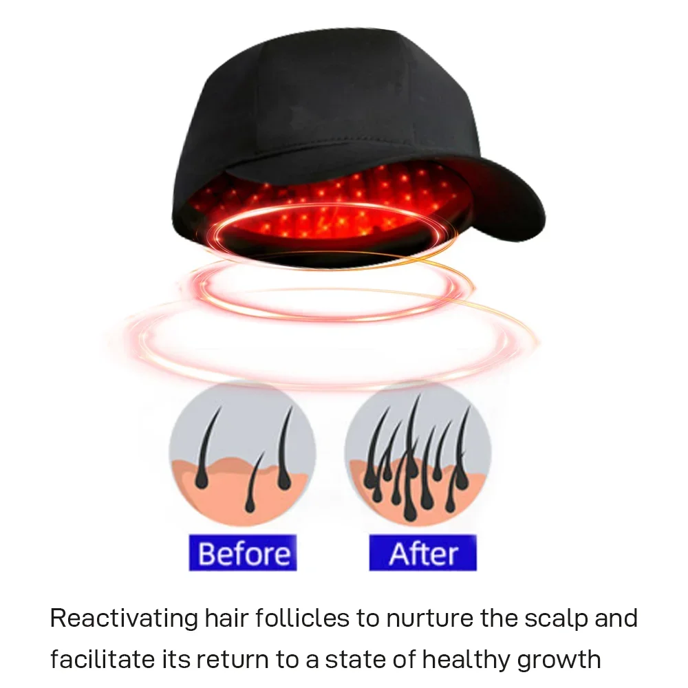 

Led Hat Laser Hair Regrowth Treatment Instrument Red Light Therapy Helmet Laser Hair Cap