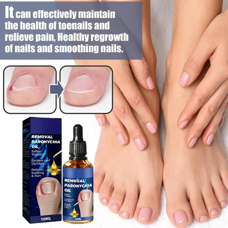 10ML Nail Correction Ingrown Toenail Liquid With Ease Oil Nail Softener Trim Feet Care Nail Corrector Pedicure Tool