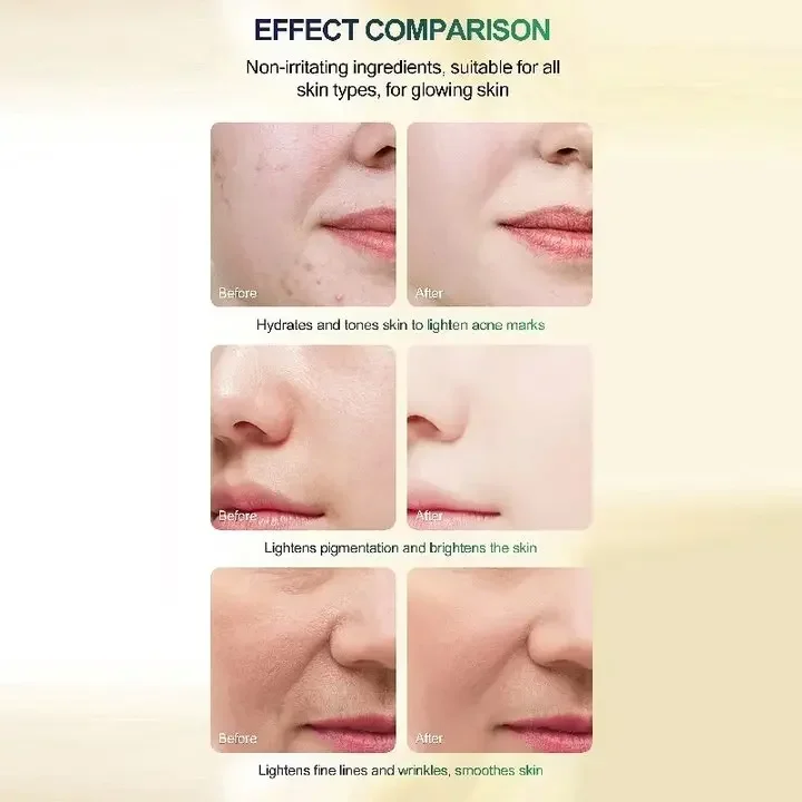 Рисунок 6 - Желтый пилинг, масло