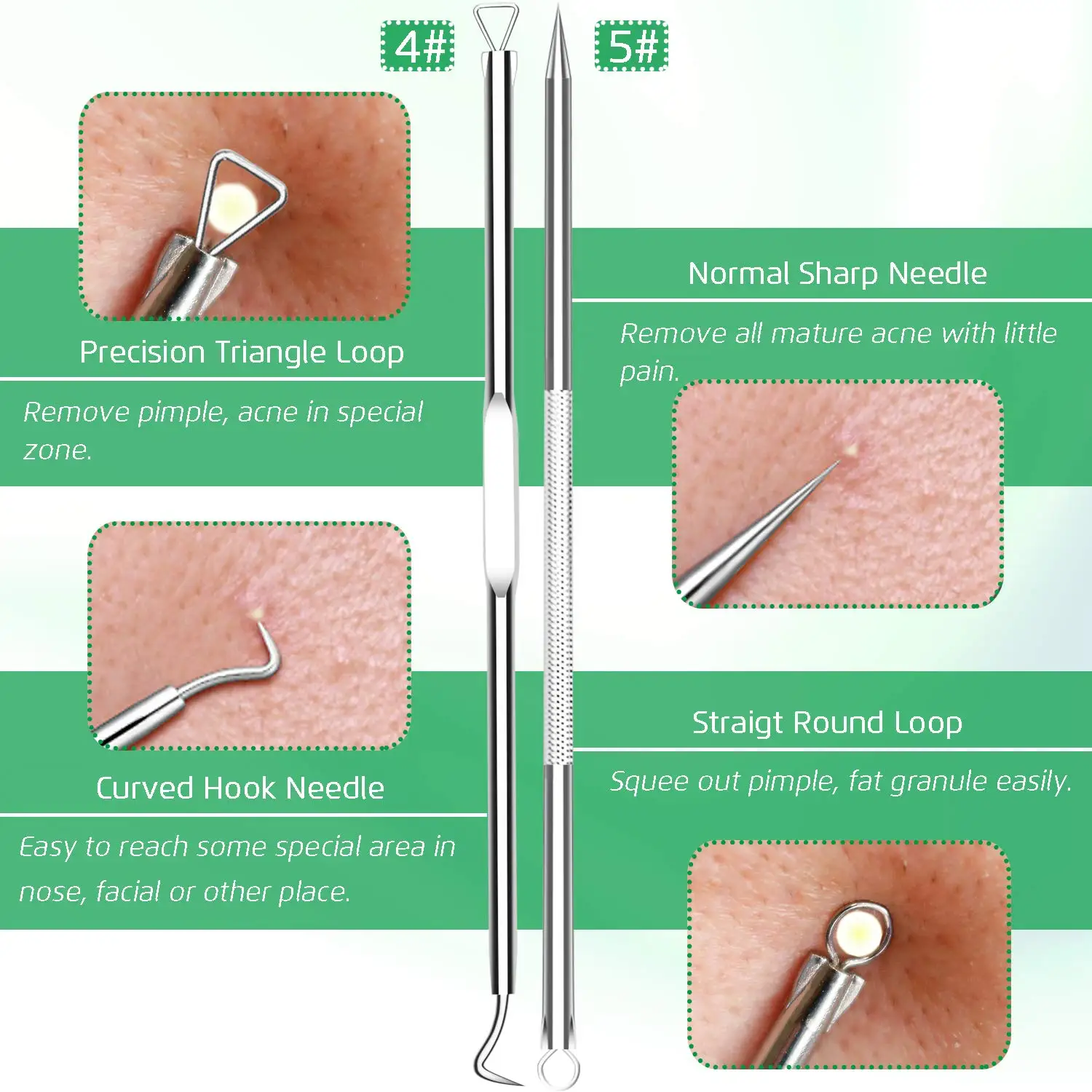 Estrattore di comedoni per la rimozione di punti neri da 5 pezzi, kit di pinzette per punti neri curvi, anche per la rimozione delle imperfezioni dell'acne con brufoli in acciaio inossidabile professionale