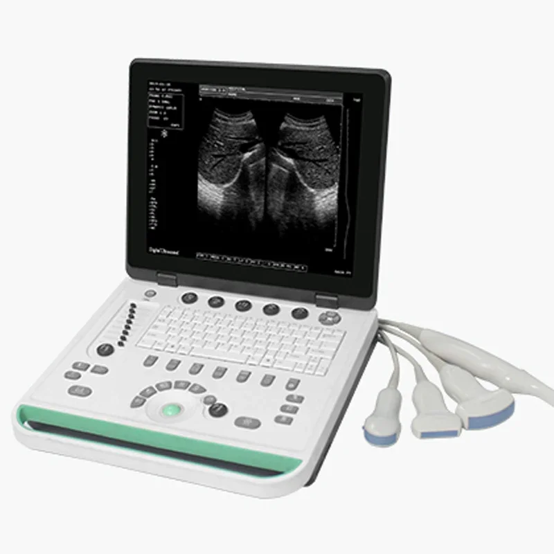 15 Inch Cheap Hotsell SS-7 Vet Ultrasound Portable Machine Equipment High Image