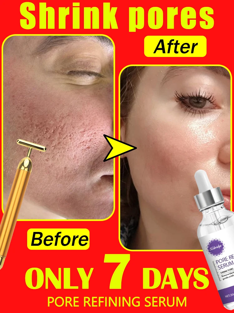 

pore reducer serum pores