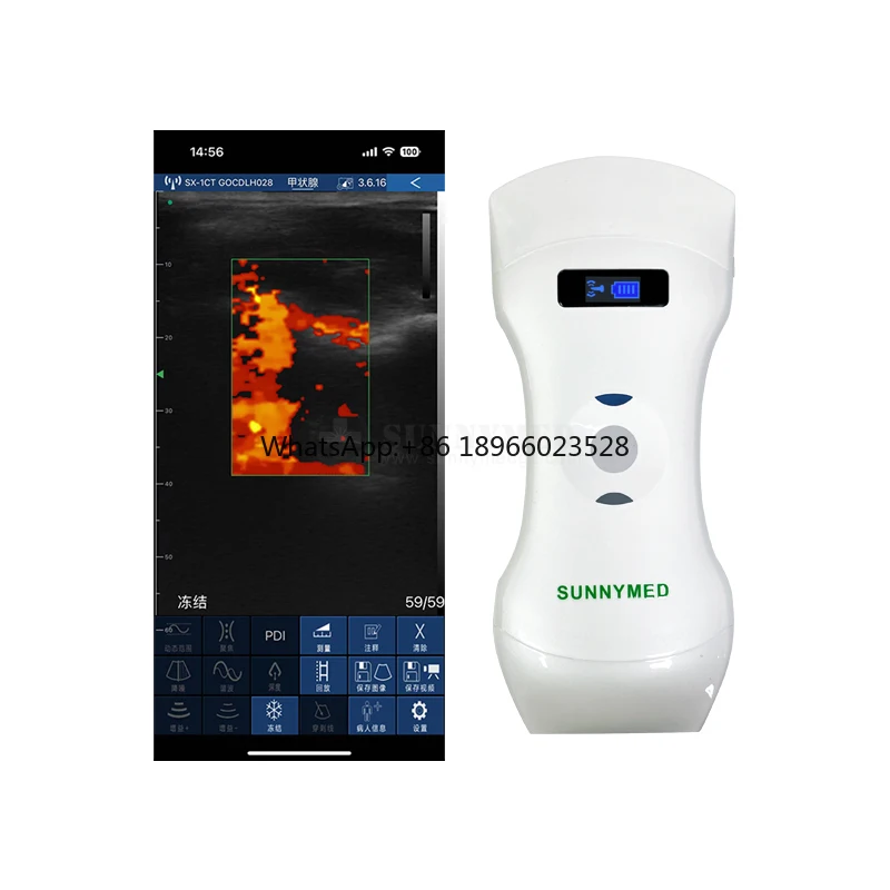 

SY-AC51_CPL High Speed Clear Image Linear/Convex Probe Portable Ultrasound Wireless Wifi Handheld Ultrasound Scanner