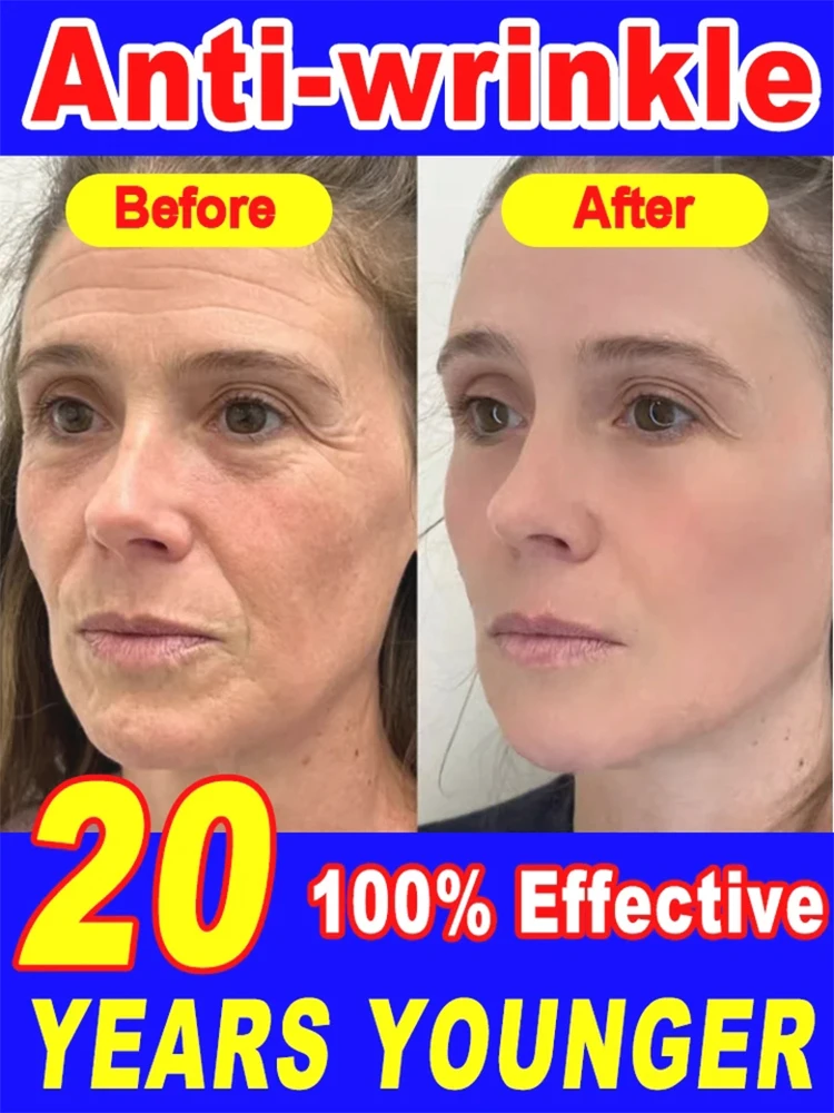 

bubbles skincare Wrinkle removal cream Anti-wrinkle facial cream facial lifting beauty-health Remove care massagersFacial Wrink