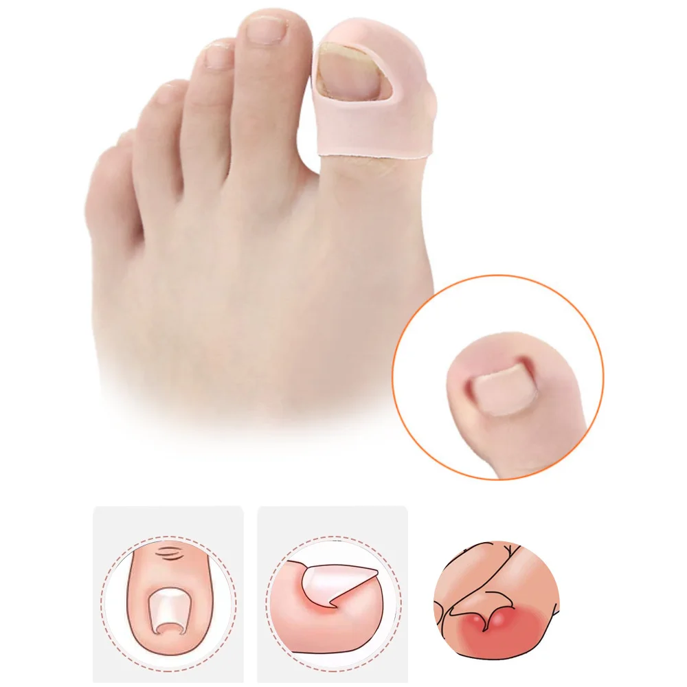 4Pcs=2Pairs Silicone Ingrown Toenail Pedicure Correction Invisible Ingrown Toe Nail Treatment Elastic Straightening Clip Brace