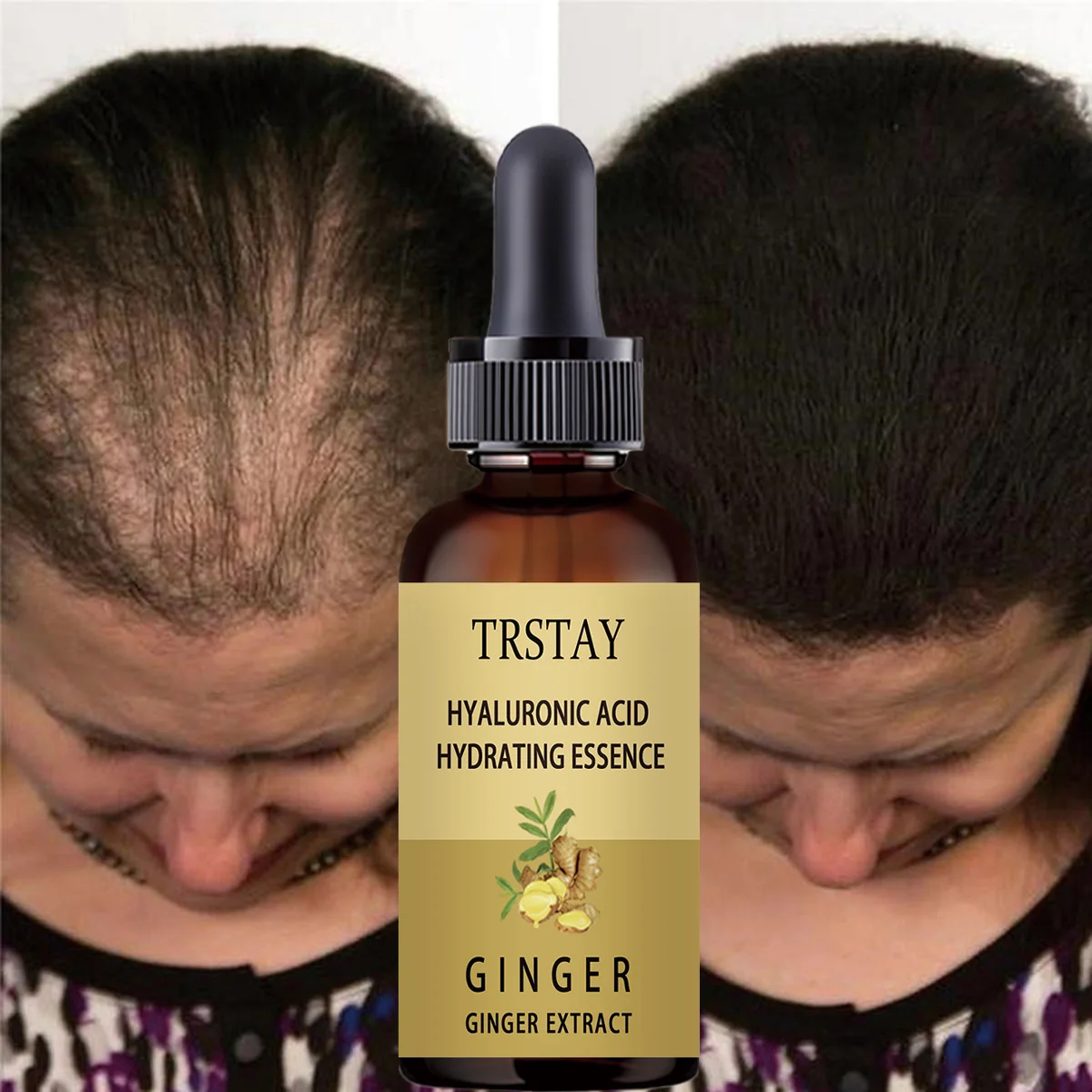 

Питательный раствор для роста волос Ginger, 7 дней, средство против выпадения волос, эфирное масло для мужчин, уход за волосами, Кондиционер для волос для мужчин
