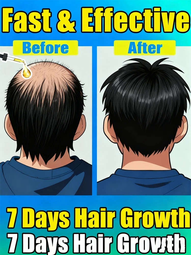 

Я был лысым и моим возвратом волос после использования этого продукта.