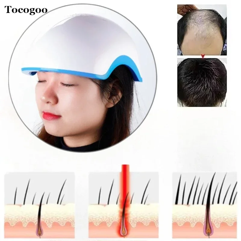 

Hair Regrowth Laser Helmet Anti Hair Loss Treatment Hair Growth Cap 80 LED Therapy Hat
