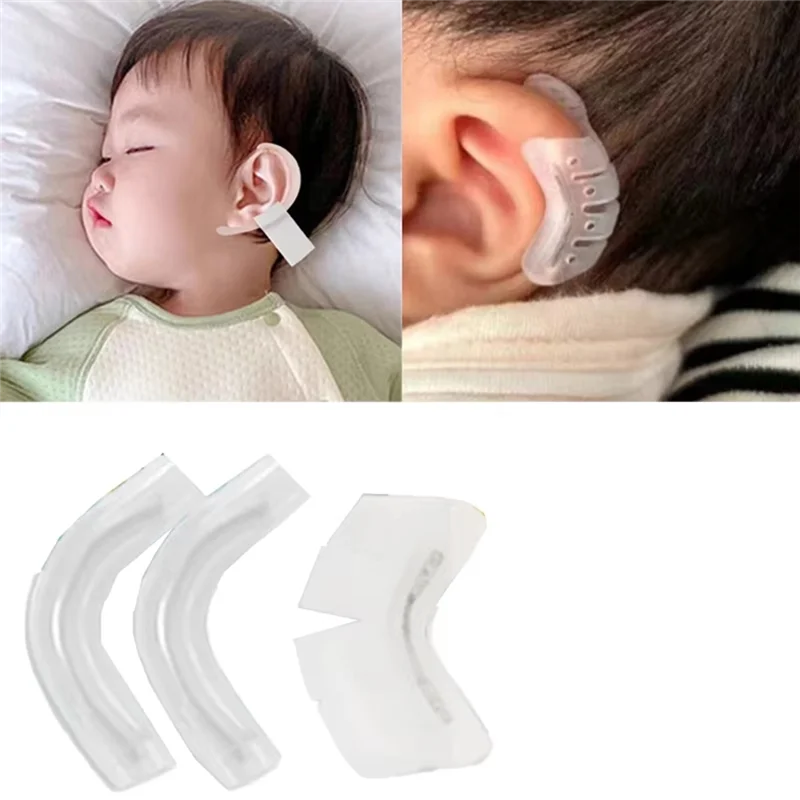 AS96-Płaster korygujący wybrzuszone uszy, wsparcie dla wybrzuszonego ucha, korektor dla niemowląt, korektor zewnętrznego wybrzuszonego ucha dla dzieci B