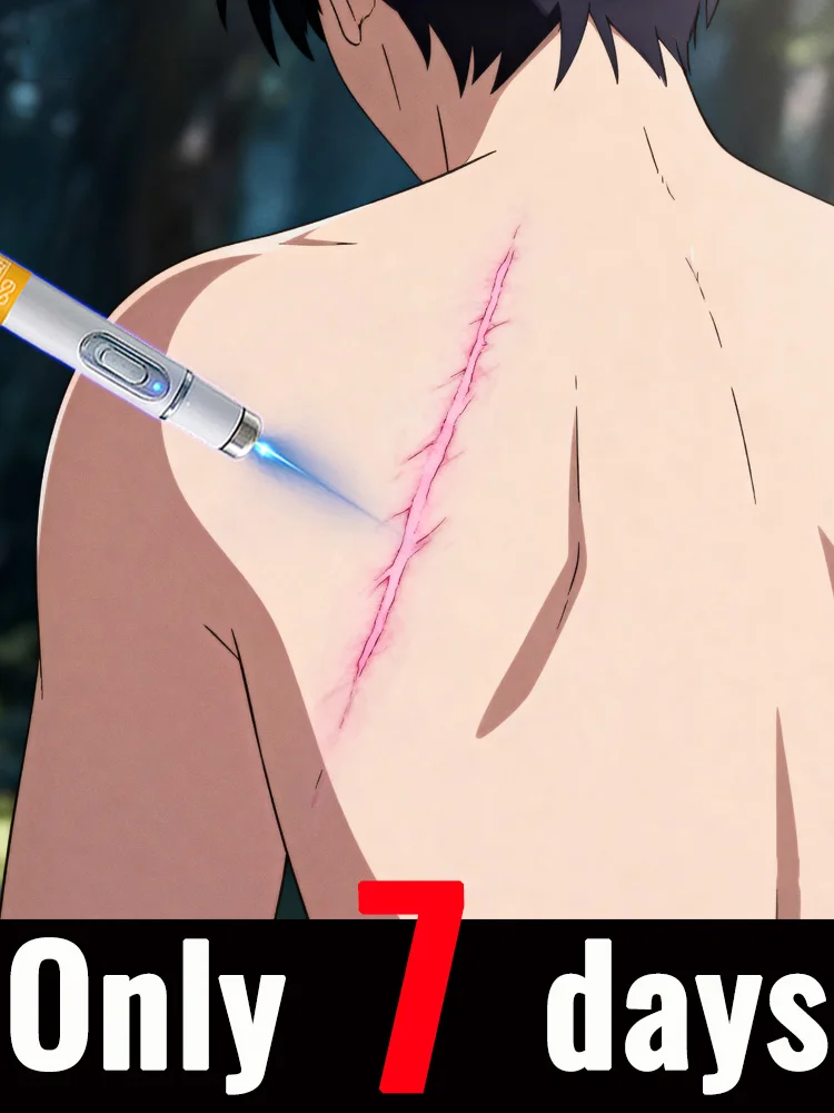 

2nd ᵍᵉⁿᵉʳᵃᵗⁱᵒⁿ ᵘᵖᵍʳᵃᵈᵉᵈ sᶜᵃʳ ⸴ ʳᵉpᵃⁱʳ sᶜᵃʳˢ ʳᵒoᵗ ⸴ ᑫᵘⁱᶜᵏˡʸ