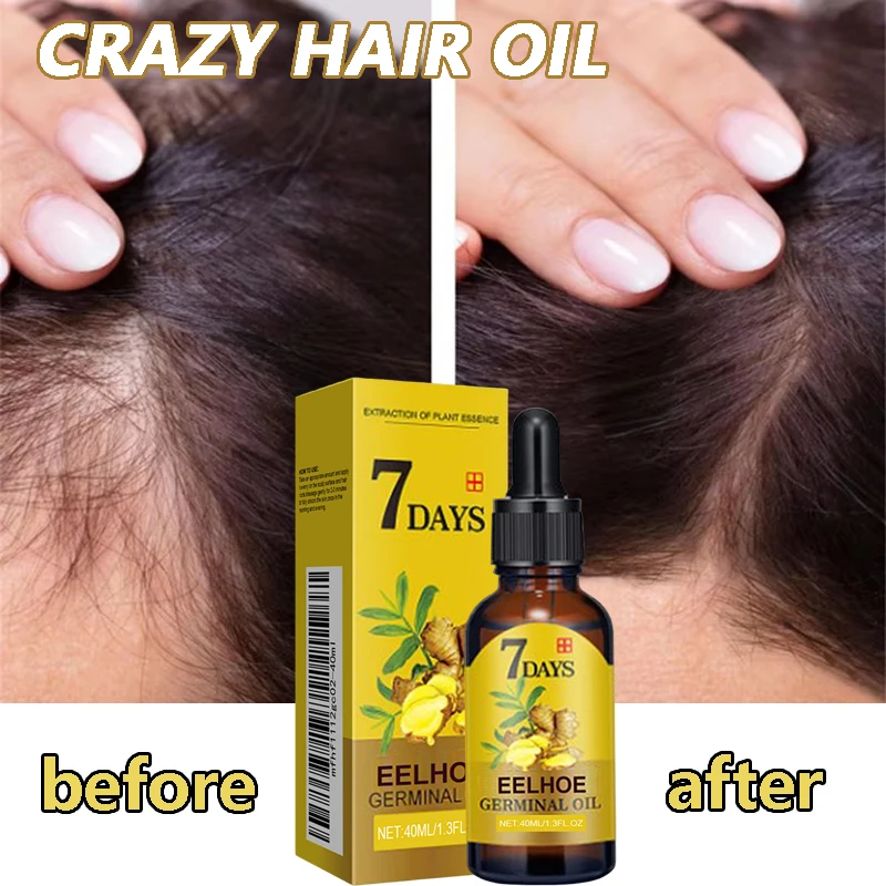 

Ginger Hair Growth Products Fast Growing Hair Essential Oil Natural Anti Hair Loss Prevent Hair Dry Frizzy Damaged Repair Care