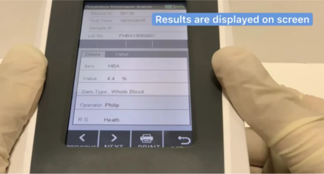 Cheap Price POCT Dry Fluorescence Immunoassay Analyzer/ Portable Handheld Immunofluorescence Analyzer