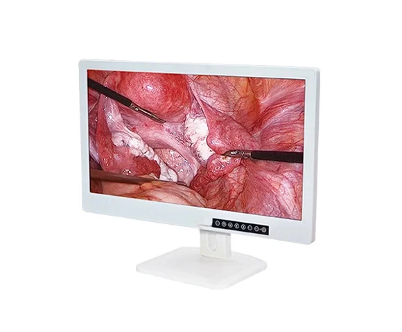 Made In China Minimal Invasive Surgery Medical Endoscope  Monitors