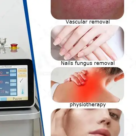 2026 Mecavie 980nm 4-in-1 Diode Laser Spider Vein Nail Fungus Skin Rejuvenation Device