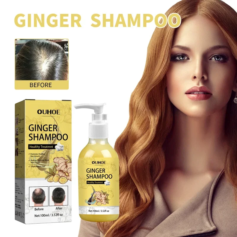

Ginger Shampoo for Hair Growth - Helps Reduce Hair Loss, Nourishes Scalp & Adds Volume for Thicker Looking Hair