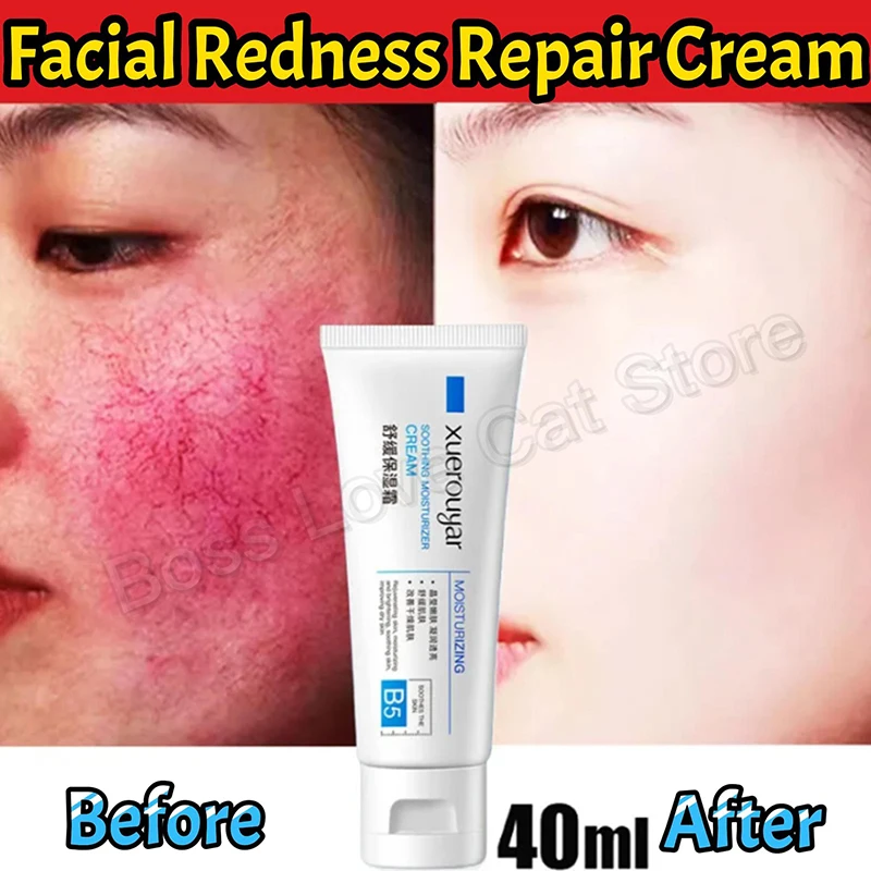 7 Day Repair Facial Redness Cream Soothing Redness Repair Skin Rosacea Red Blood Improve Sensitive Skin CareKorean Cosmetic 40ml