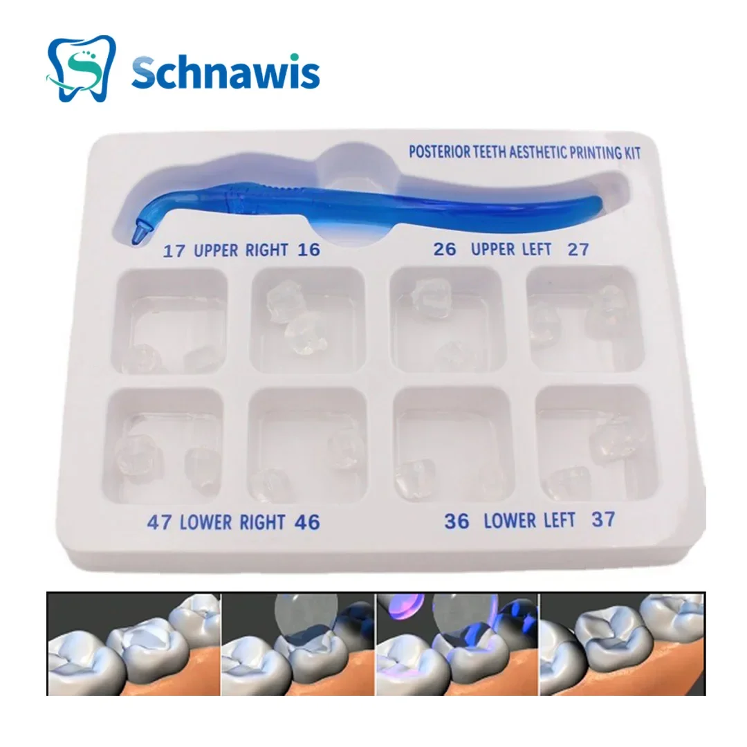 Dental Posterior Teeth Aesthetic Printing Mould Kit For Light Cure Composite Restoration Filling Tools