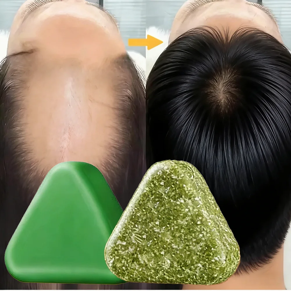 Champú a base de hierbas naturales, jabón hecho a mano de hierba Usman, nutritivo para el cabello, Control de aceite, cuidado del cabello refrescante, esponjoso y calmante