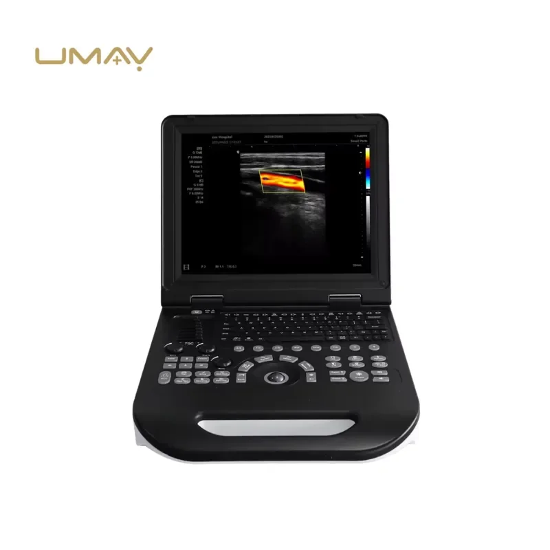 UMUS031 High Quality Medical Diagnostic Portable Machine with Convex Probe 15