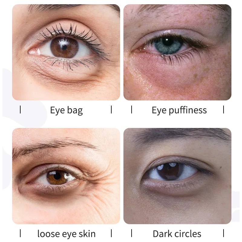 Vitamina C para eliminar las bolsas de los ojos, melanina de la piel, diluye las líneas finas, mejora las ojeras, esencia VC, suero ocular