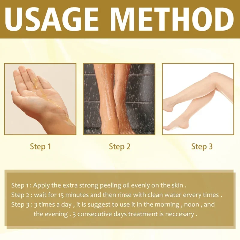 With Malic Acid And Citric Acid For Face  Facial Peel 40% Peeling Serum Peeling Serum Peel - Image 3