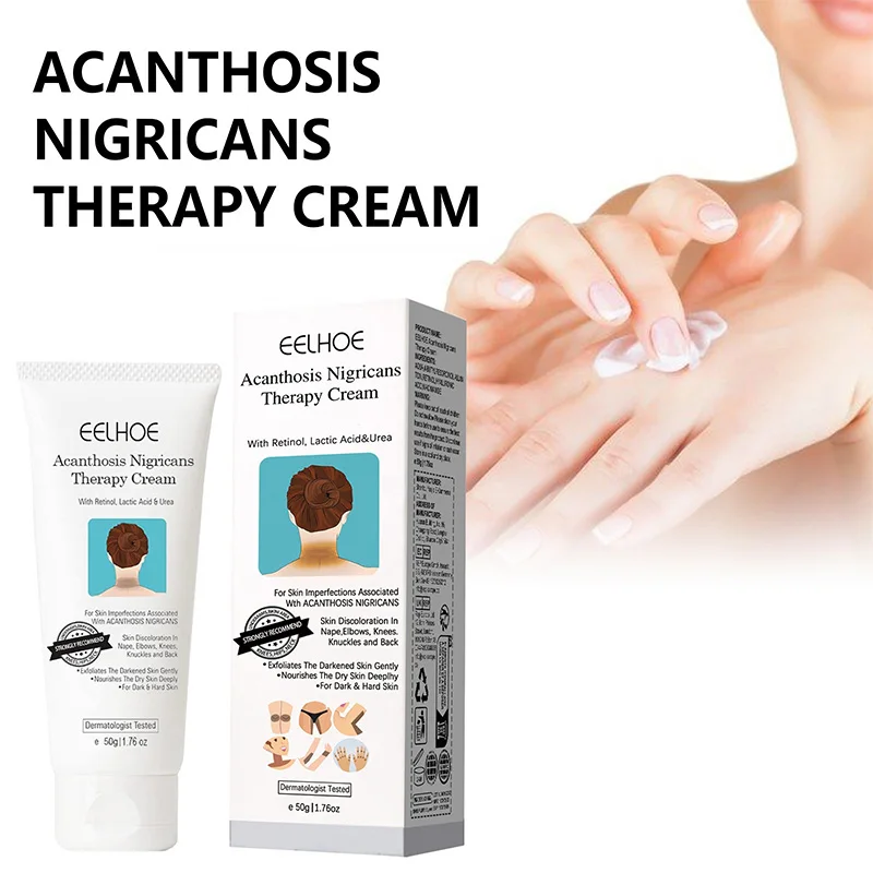 EELHOE Body Whitening Cream Used To Repair Skin Discoloration on Knees Elbows Knees Knuckles and Back Remove Melanin