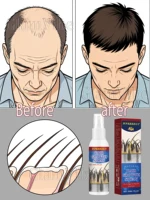 Promueve el crecimiento de la raíz del cabello y te dar un cabello hermoso.