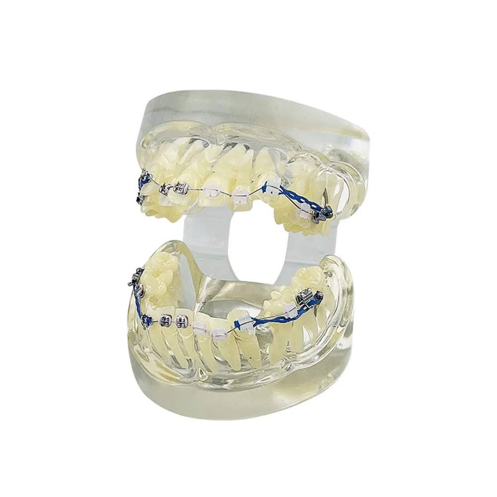 Orthodontic Treatment Model Dental Typodont Teeth Demonstration Model With Braces Brackets Chain Ties Arch Wire Dentistry Model