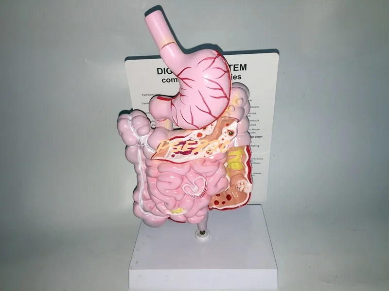 Medical Human Digestive System Large Intestine model Rectum Duodenum Viscera Gastrointestinal Anatomy Model Teaching Supplies