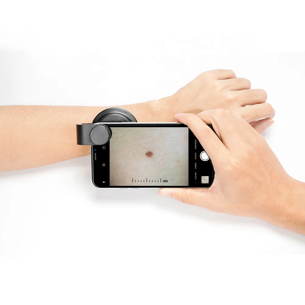 IBOOLO Electric Smartphone Polarized Dermoscope Mini Device For Skin Cancer Home And Clinical Use