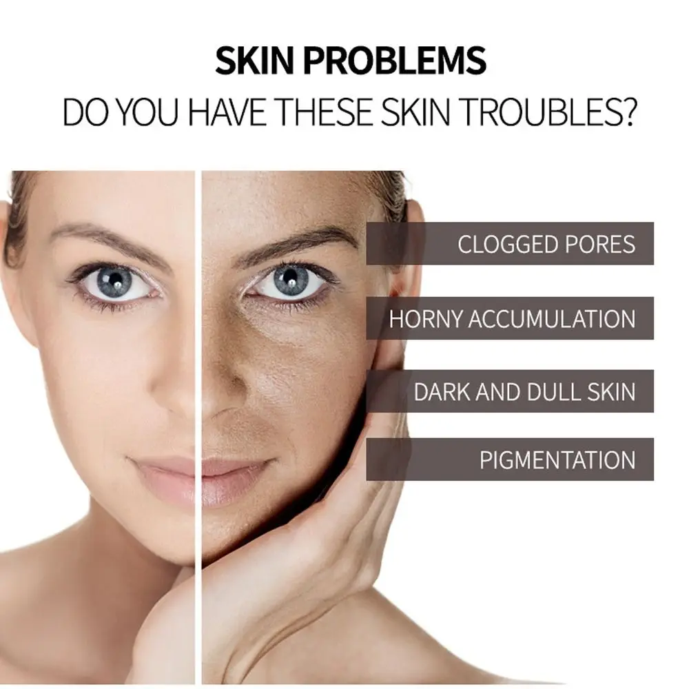 

Deep Cleaning Body Cleansing Exfoliator Dead Skin Remove Whitening Hydrating Exfoliating Gel Facial Care