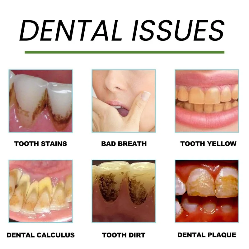 Dentifrice à la propolis pour livres dentaires, blanchiment des dents SAF, élimination de la mauvaise haleine, soins de nettoyage dentaire