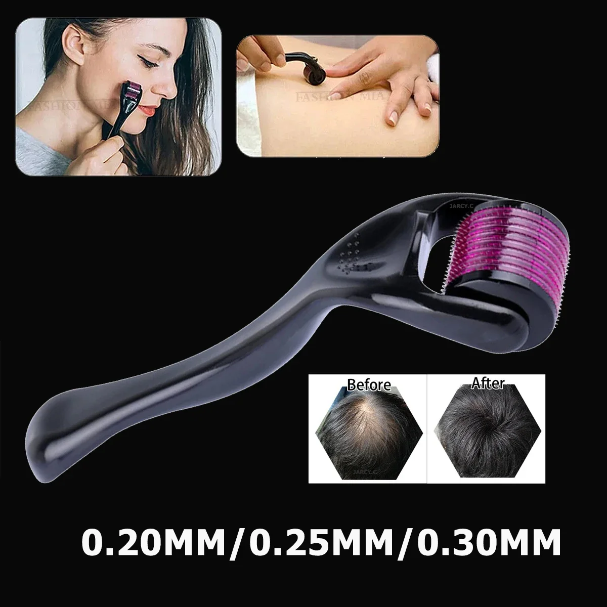 

Drs 540 Roller Micro Needles Titanium Mezoroller Microneedle for Hair Growth Beauty Facial Skin Care Mesotherapy Treatment