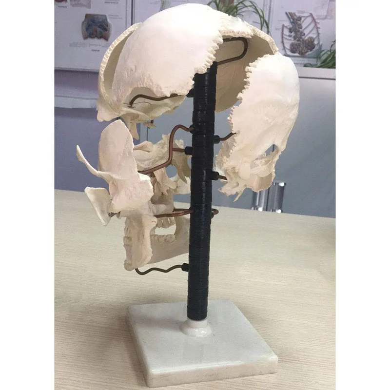 Human skull parts (16 pieces) Human skull model Human skull model Skull separation anatomical medical bone model