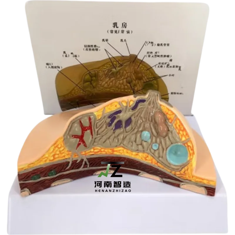 

Breast Pathological Anatomy Model Breast Lesion Anatomical Model