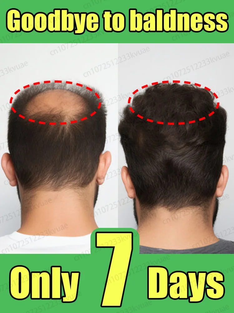 Hair growth essential oil. Effectively repair baldness and hair loss symptoms