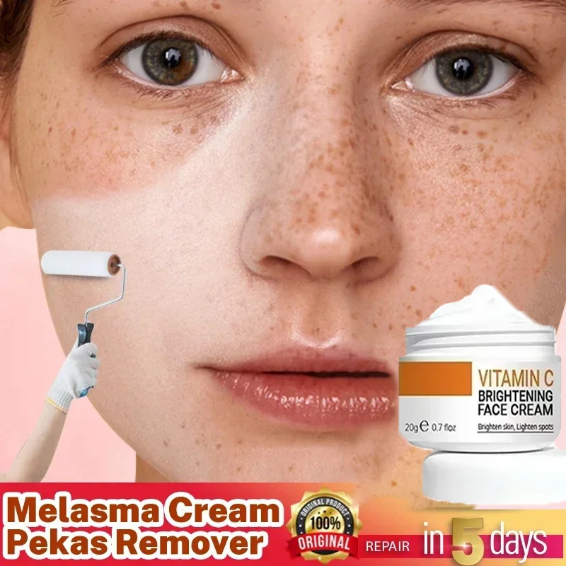 Powerful Whitening Cream Skin Care Remove Freckle Melasma Dark Spots Corrector Lighten Melanin Pigmentation Brighten Product