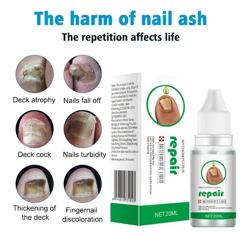 Strong Nail Fungus Treatment Serum Essence oil Feet Nails Repair Care Essence Cream Anti Infection Toe Fungal Removal