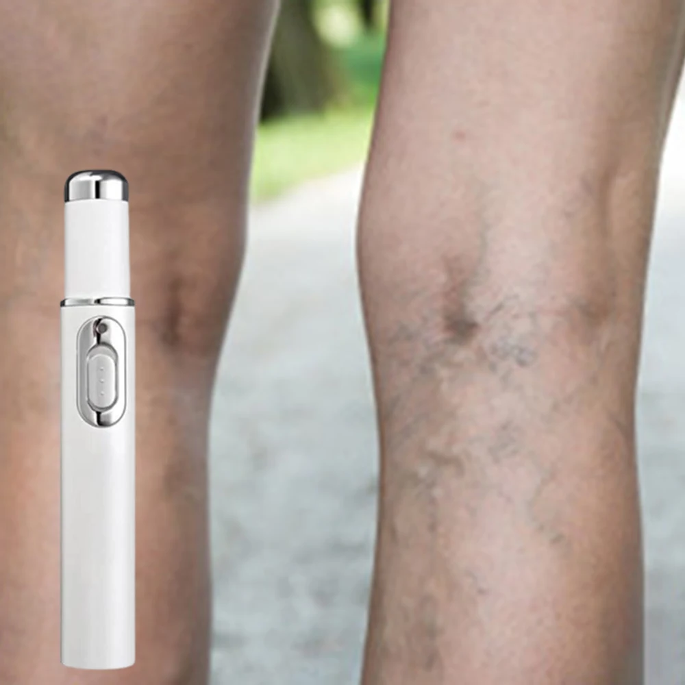 

eg Care Nourish Hot Original LMoisturize Gentle Massage Relieves Leg Discomfort Improve Varicose Veins Body Care 2025 New