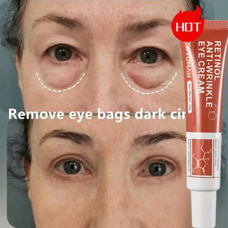 Anti-Dark Circles Eye Cream Whitening Removes Eye Bags Anti-Puffiness Lightening Eye Fine Line Wrinkle Face Skin Care Korean