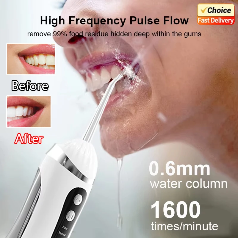 

Новинка 2023 года, портативный стоматологический ирригатор для воды, ирригатор для полости рта, 4 насадки, 3 режима, USB перезаряжаемый очиститель зубов для домашнего использования в путешествиях