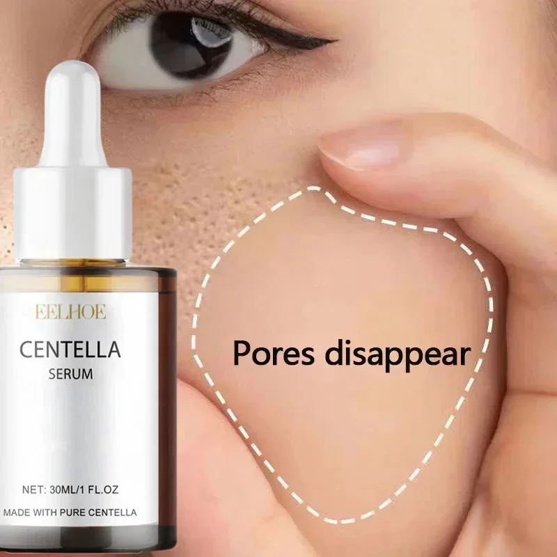 Centella Asiatica suero Facial nutre la piel seca suavizante rejuvenecimiento brillo de la piel crema blanqueadora hidratante Facial coreano