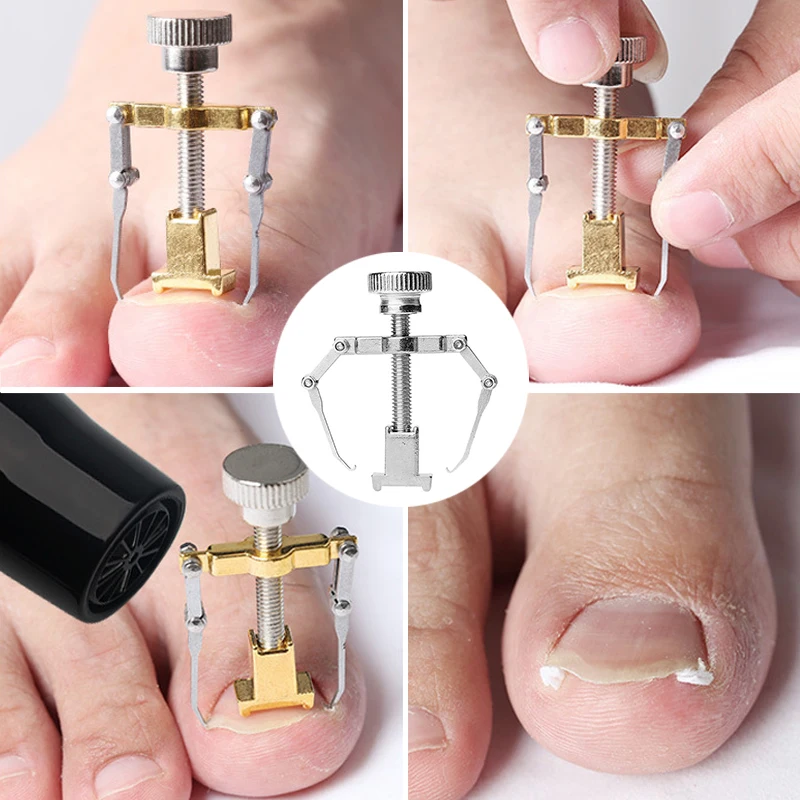 Nail Straighten Clip Ingrown Pedicure Tool Toenail Corrector Clip Cure Ingrown Toenails Health Care Relief Pain Stainless Steel