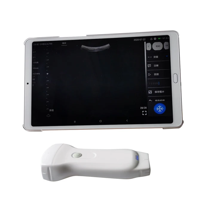 2024 Cost-effective Wireless Color Doppler Ultrasound Machine  Double Heads MSLPU80