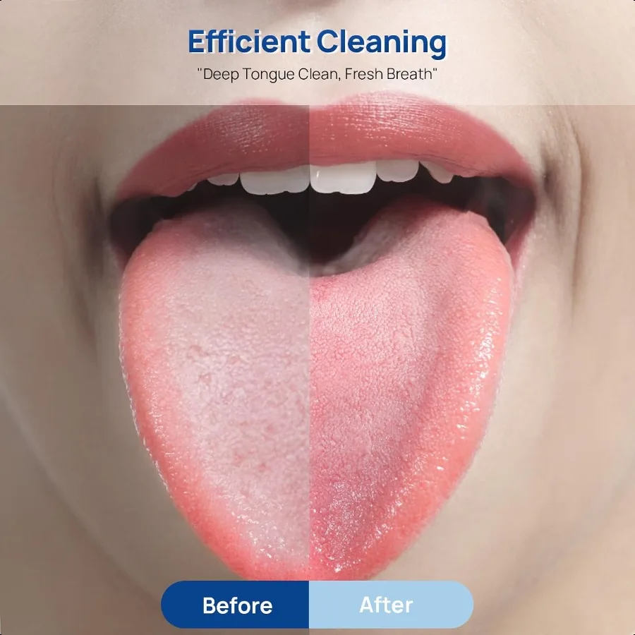 قطعتان من مكشطة اللسان مع حقيبة سفر من الفولاذ المقاوم للصدأ لتنظيف اللسان للبالغين #3